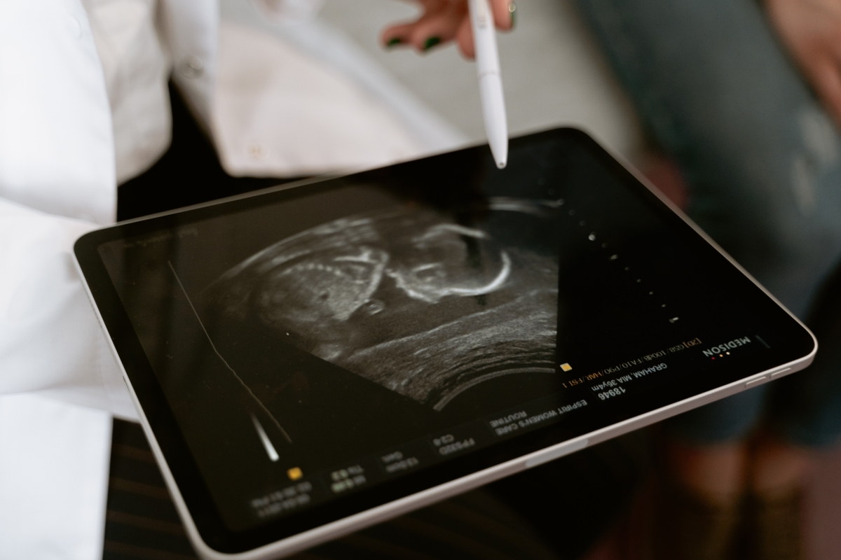 Book a private Pregnancy Ultrasound scan near you